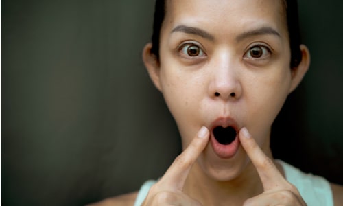 How To Get Rid Of Lines Without Botox & Expensive Products face yoga
